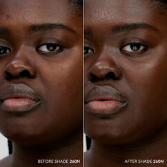 Skin Base, 260N, large, image4