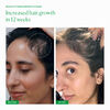 Growth Phase, , large, image3