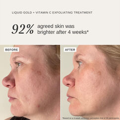 Liquid Gold + Vitamin C, , large, image4