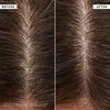 Flaky/Itchy Anti-Dandruff Scalp Toner, , large, image4