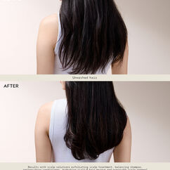 Scalp Solutions Intensive Hair Mask, , large, image8