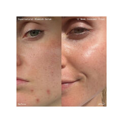 Supernatural Blemish Face Serum, , large, image9