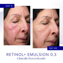 Retinol + Emulsion 0.3, , large, image4