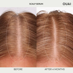 Scalp Serum, , large, image6