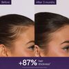 Anti-Hair Loss Serum, , large, image4