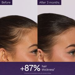 Anti-Hair Loss Serum, , large, image4