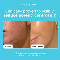 The Breakout Fighting Kit, , large, image4