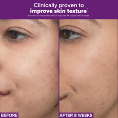 Clinical Pro Retinaldehyde Dual-Retinoid Treatment, , large, image10