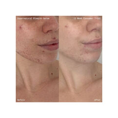 Supernatural Blemish Face Serum Refill, , large, image7