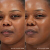 Skin Base, 210 W, large, image4