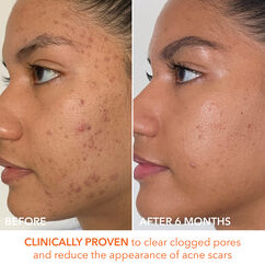 Advanced Retinol + Ferulic Overnight Texutre Renewal Peel, , large, image10