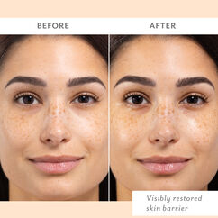 Skin Remedy Barrier-Boosting Sheet Mask, , large, image3