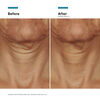 Tripeptide-R Neck Repair, , large, image7