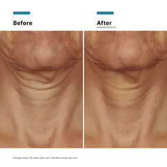 Tripeptide-R Neck Repair, , large, image7