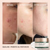 Probiotic Gel Moisturizer, , large, image4