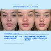 Biome-Balancing Clear & Prevent Blemish Treatment Serum, , large, image2