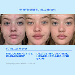 Biome-Balancing Clear & Prevent Blemish Treatment Serum, , large, image2