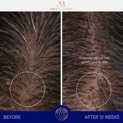 The Leave-In Hair Treatment, , large, image10