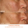 Vitamin C + Lactic 15% Vitamin C Firm & Bright Serum, , large, image5
