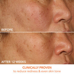 Vitamin C + Lactic 15% Vitamin C Firm & Bright Serum, , large, image5
