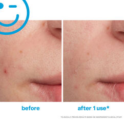 EradiKate Blemish Spot Treatment, , large, image5