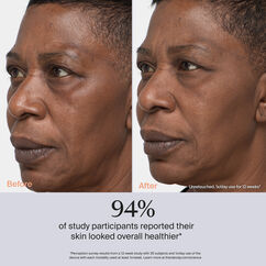 TheraFace PRO- White, , large, image4