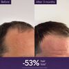 Anti-Hair Loss Serum, , large, image3