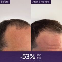 Anti-Hair Loss Serum, , large, image3