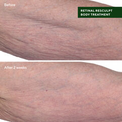 Retinal ReSculpt Body Treatment, , large, image6