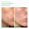 Skin Filter, , large, image6
