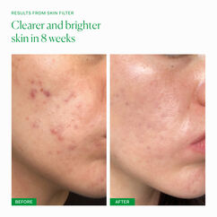 Skin Filter, , large, image6