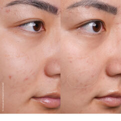 Banana Bright Vitamin C Serum, , large, image8