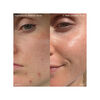 Supernatural Blemish Face Serum Refill, , large, image8