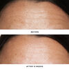 Double Rewind 0.3% Pro-Grade Retinol Serum, , large, image7