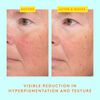 C-Luma™ Hydrabright Serum, , large, image5