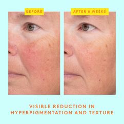 C-Luma™ Hydrabright Serum, , large, image5