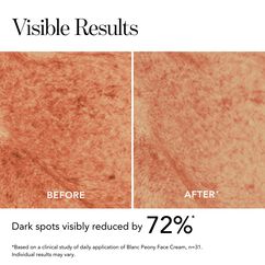 Blanc Peony Face Cream Dark Spot Corrector, , large, image5