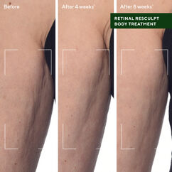 Retinal ReSculpt Body Treatment, , large, image5