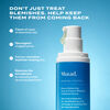 Biome-Balancing Clear & Prevent Blemish Treatment Serum, , large, image6