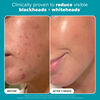 2% BHA Exfoliating Toner Pads, , large, image3