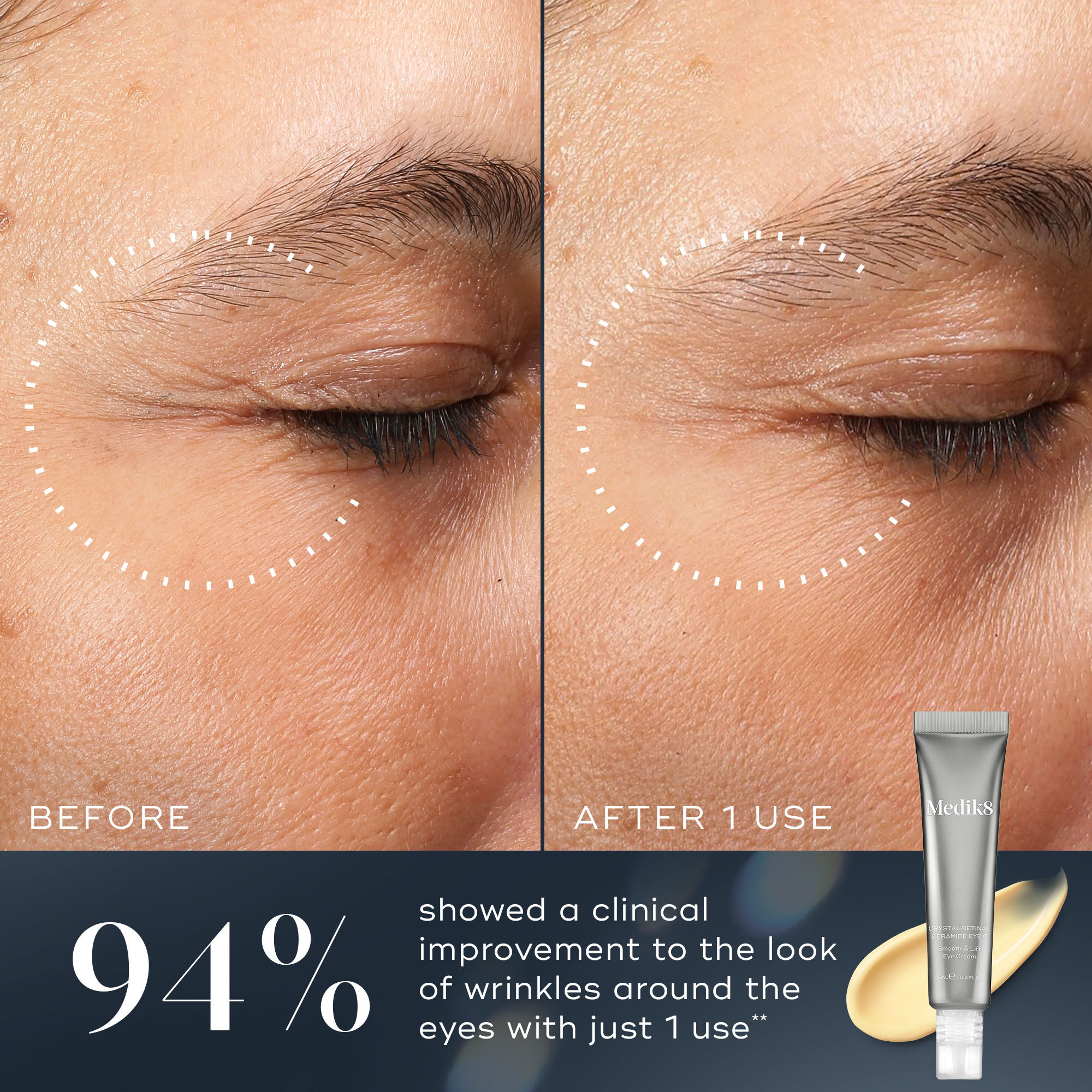 Medik8 Crystal Retinal Ceramide Eye 3 | Space NK
