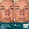 Moisture Minis Kit, , large, image8