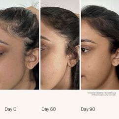 Scalp Care Density Serum, , large, image2