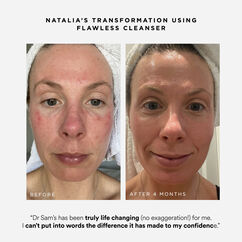 Flawless Cleanser, , large, image4