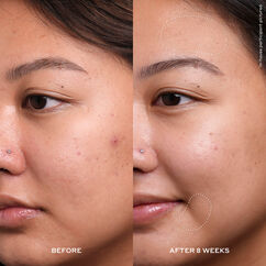 Dewtopia 20% Acid Night Treatment, , large, image3