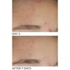Alpha Beta® On The Spot Gel, , large, image10