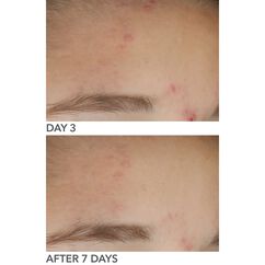 Alpha Beta® On The Spot Gel, , large, image10