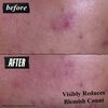 Blemish-Treating Cleansing Paste, , large, image2