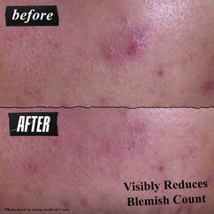 Blemish-Treating Cleansing Paste, , large, image2