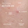 Corrective Serum Blemish Prone Skin, , large, image7